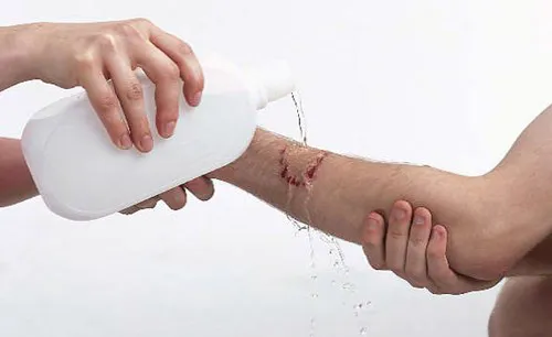 Sơ cứu mèo bị xe cán: Hướng dẫn chi tiết từ A-Z