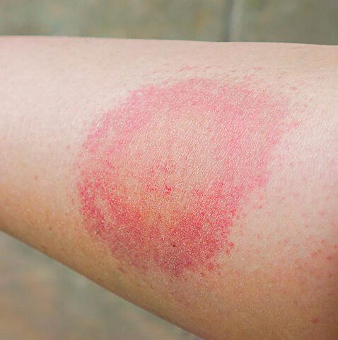 Nguyên nhân mèo bị phát ban đỏ khắp người và cách xử lý