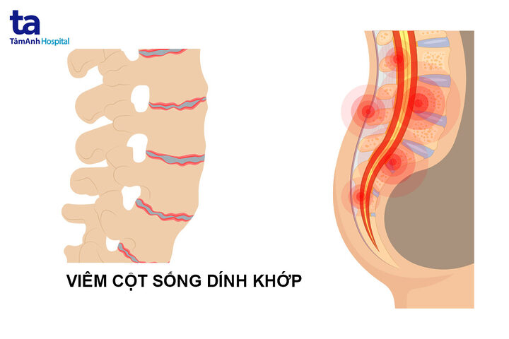 Cách chữa mèo bị viêm cột sống hiệu quả
