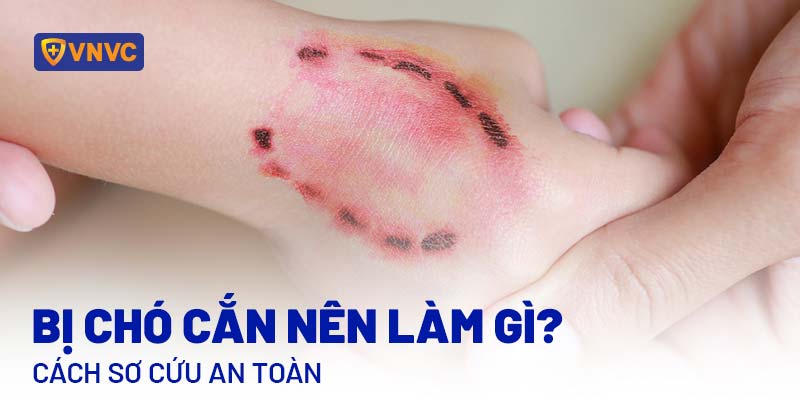 Sơ cứu mèo bị xe cán: Hướng dẫn chi tiết từ A-Z