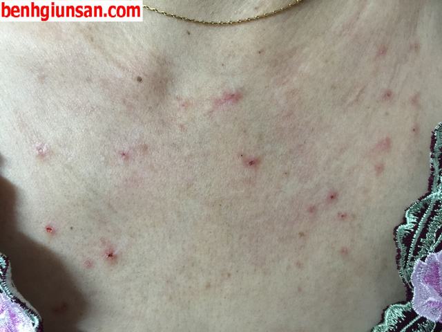 Mèo bị ngứa ở mặt: Dấu hiệu, nguyên nhân và giải pháp