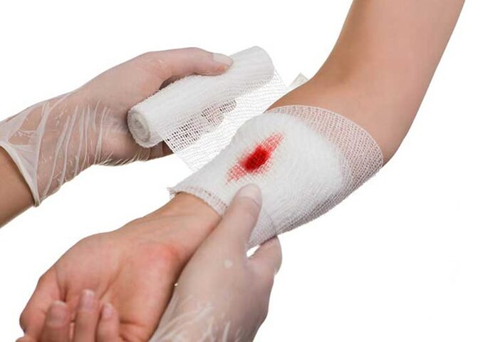 Hướng dẫn sơ cứu cho mèo bị chó cắn hiệu quả và an toàn