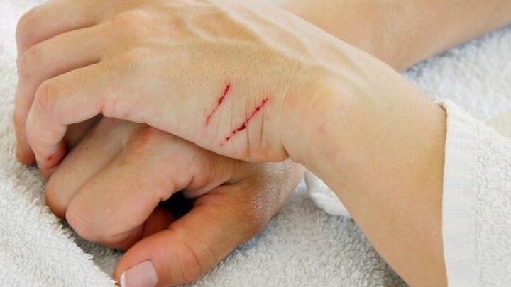 Mèo Bị Cào: Hiểu Rõ Rủi Ro, Cách Xử Lý Và Phòng Ngừa