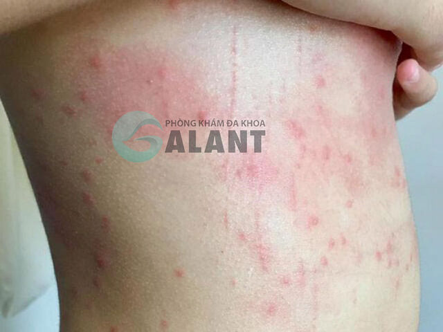 Mèo Bị Sán: Dấu Hiệu, Nguyên Nhân, Cách Điều Trị Và Phòng Ngừa Hiệu Quả