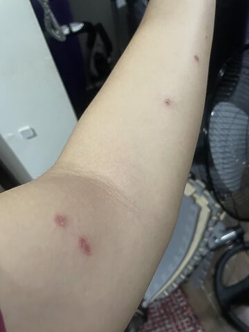 Mèo Bị Sốt Sau Chích Ngừa: Nguyên Nhân & Cách Xử Lý