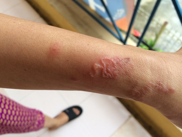 Mèo Bị Sán: Dấu Hiệu, Nguyên Nhân, Cách Điều Trị Và Phòng Ngừa Hiệu Quả