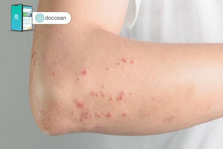 Mèo Bị Sán: Dấu Hiệu, Nguyên Nhân, Cách Điều Trị Và Phòng Ngừa Hiệu Quả