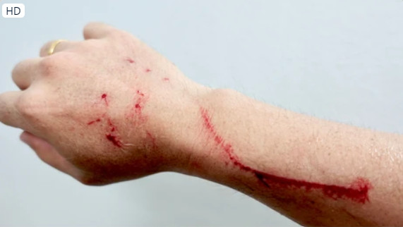 Mèo Bị Cào: Hiểu Rõ Rủi Ro, Cách Xử Lý Và Phòng Ngừa