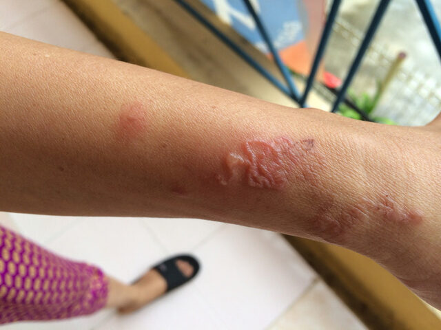 Nhiễm Trùng Máu Ở Mèo: Dấu Hiệu, Nguyên Nhân, Điều Trị