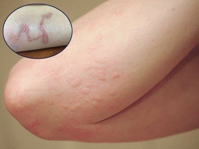Nuôi Chó Có Bị Sán Chó Không: Nguy Cơ, Dấu Hiệu và Cách Phòng Ngừa Hiệu Quả - image 2