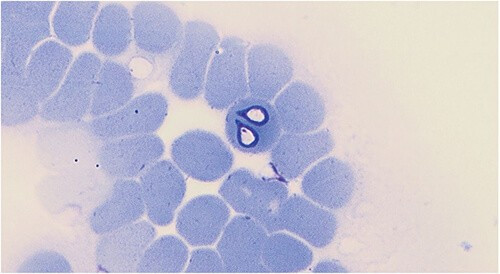 Babesia canis trong hồng cầu