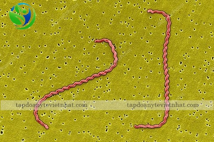 Bệnh Lepto ở Chó Lây Sang Người: Triệu Chứng, Nguy Cơ và Cách Phòng Ngừa Hiệu Quả