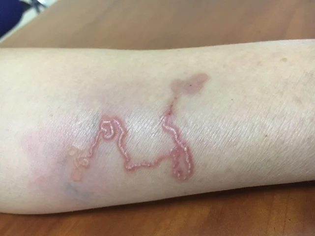 Bệnh Giun Đũa Chó Nên Kiêng Ăn Gì: Hướng Dẫn Chi Tiết