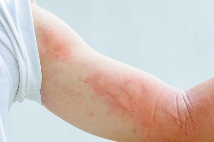 Cách Trị Bệnh Cho Chó Tại Nhà Hiệu Quả và An Toàn