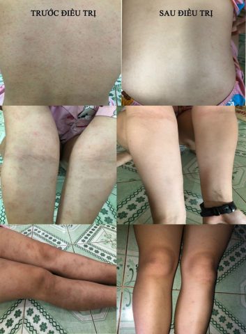 Cách Trị Bệnh Cho Chó Tại Nhà Hiệu Quả và An Toàn