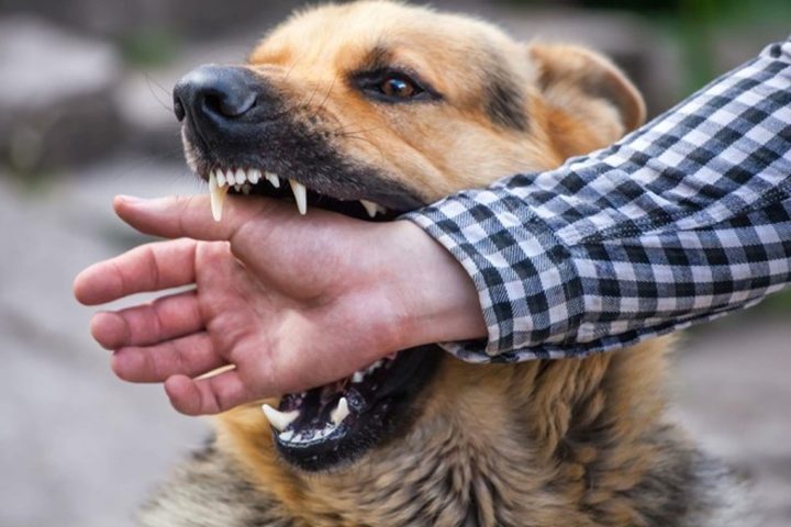 Người Bị Chó Dại Cắn: Dấu Hiệu, Nguy Cơ Và Cách Xử Lý Hiệu Quả