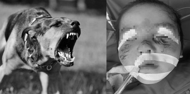 Chó Cắn Người Có Bị Dại Không? Giải Đáp Chi Tiết