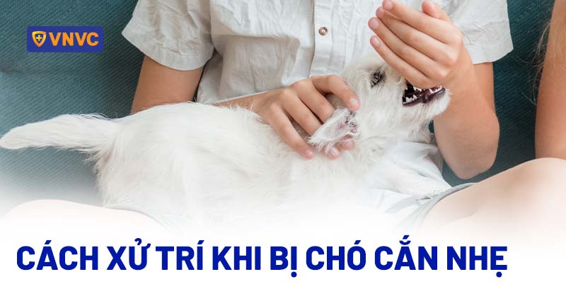 Chó Cắn Nhẹ Có Sao Không? Nguy Cơ Dại Và Cách Xử Lý Chi Tiết