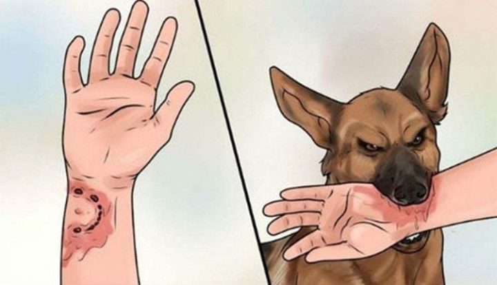 Bà Bầu Bị Chó Cắn: Nguy Hiểm, Xử Lý & Phòng Ngừa Toàn Diện