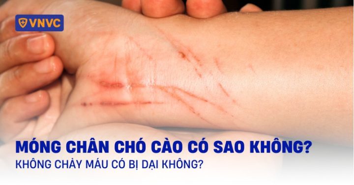 móng chân chó cào có sao không