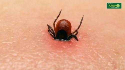 Một con ve chó trưởng thành bám chặt vào da, là hình ảnh kinh điển về ve chó cắn, đòi hỏi cách gỡ bỏ cẩn thận để tránh nhiễm trùng.