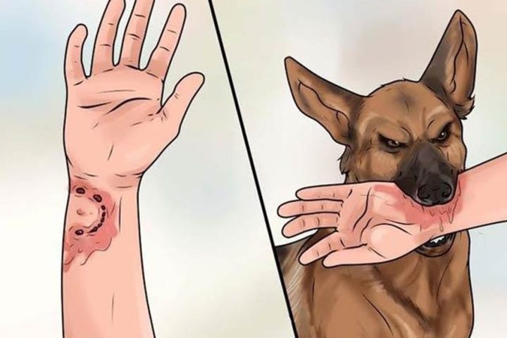 Tiêm Ngừa Chó Cắn Bao Nhiêu Mũi: Hướng Dẫn Chi Tiết Và Phác Đồ An Toàn