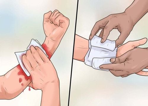  Xử lý vết thương chó cắn hoặc mèo cắn 