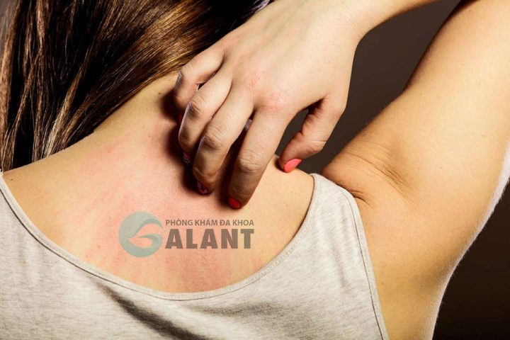 Thời Gian Ủ Bệnh Sán Chó: Điều Cần Biết Để Phòng Ngừa