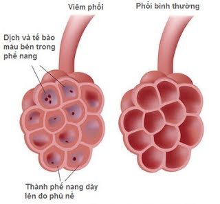 Biểu Hiện Chó Bị Viêm Phổi: Dấu Hiệu Nhận Biết & Cách Xử Lý Hiệu Quả
