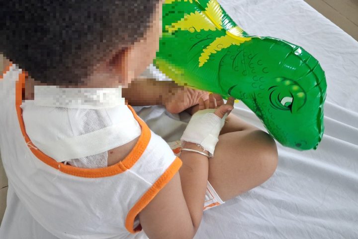 Chó bị cắn vào cổ: Hướng dẫn xử lý và phòng tránh toàn diện