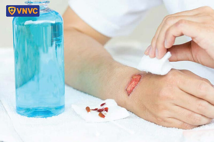 Vệ sinh vết thương sau khi bị chó dại cắn là bước đầu tiên trước khi tiêm phòng