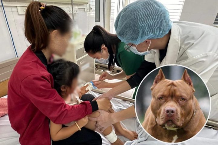 Chó Pitbull Cắn Người ở Hà Nội: Nguyên Nhân, Hậu Quả và Giải Pháp Phòng Tránh Hiệu Quả