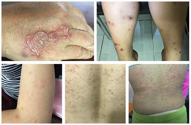 Cách phòng ngừa bệnh sán chó