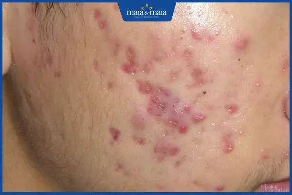 cách nhận biết luồng cá đi ăn cách nhận biết luồng cá đi ăn