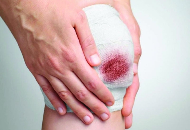 Phân tích giấc mơ thấy máu trong các nền văn hóa