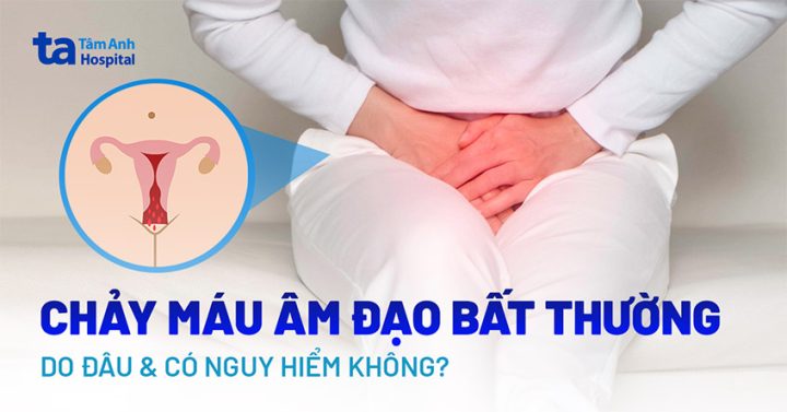 Nguyên nhân gây ra giấc mơ chảy máu vùng kín