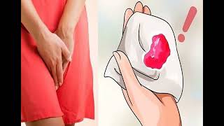 Những điều cần làm khi nằm mơ thấy chảy máu vùng kín