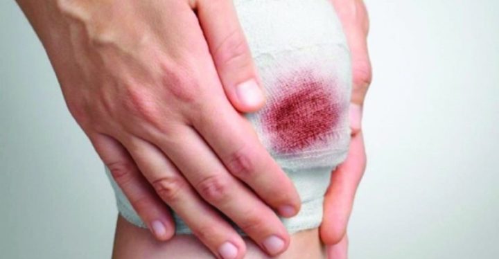 Các giấc mơ liên quan đến máu và ý nghĩa tương tự