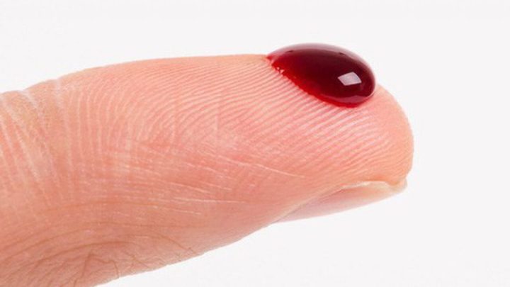 Các loại giấc mơ thấy máu phổ biến