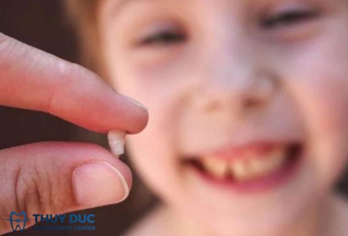 Các cách giải mã giấc mơ thấy rụng răng