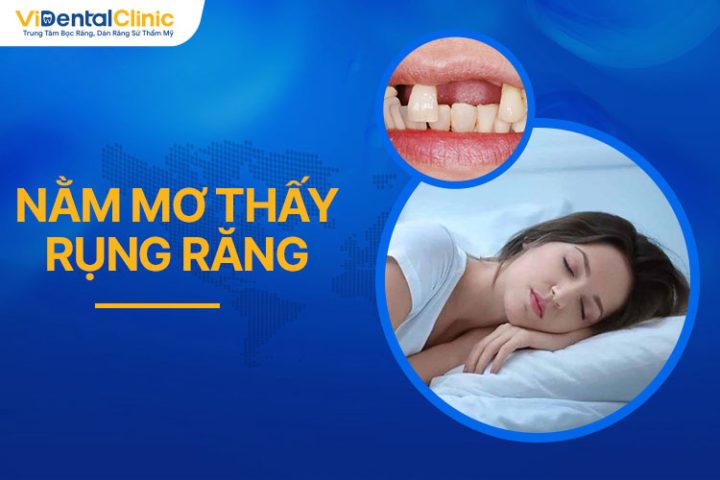 Làm gì khi thường xuyên mơ thấy rụng răng?