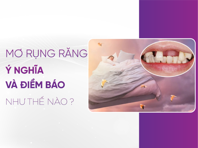 Những câu hỏi thường gặp về giấc mơ rụng răng