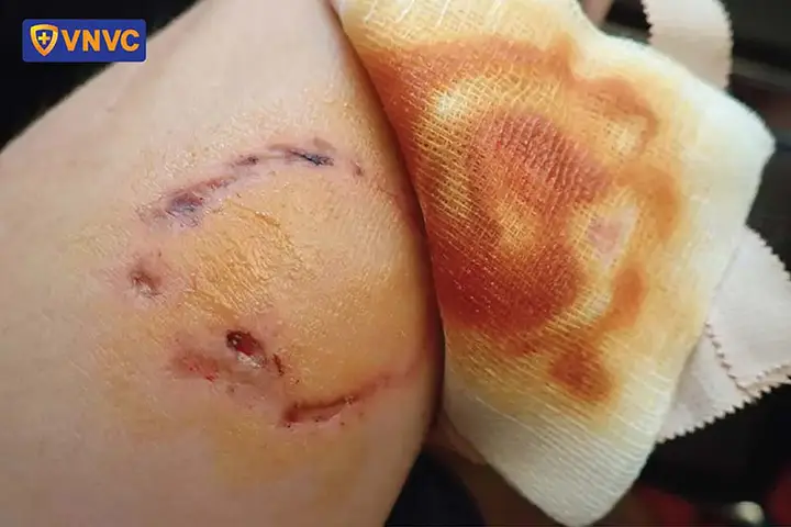 tại sao nhà không nuôi được chó